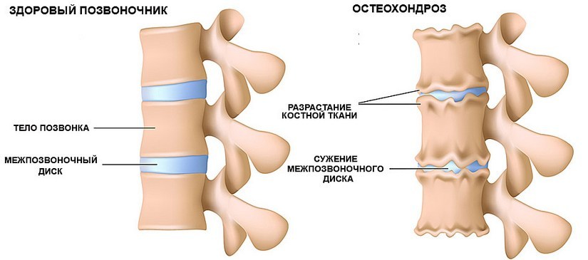 Абсолютные противопоказания к имплантации