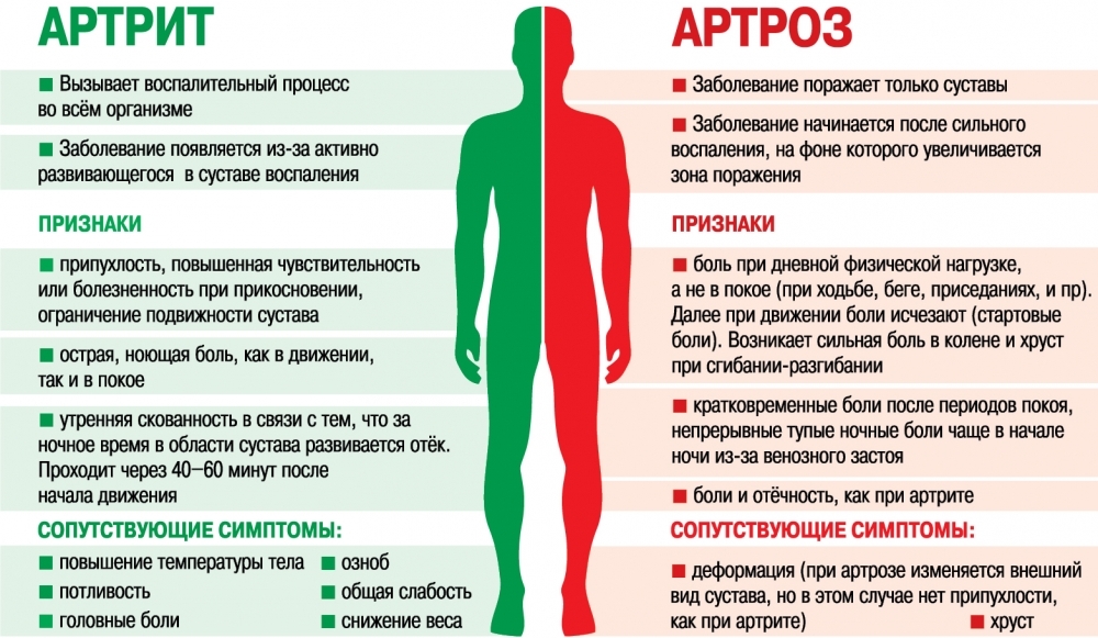 Отличия артрита от артроза