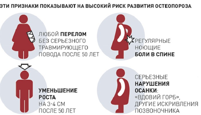 Признаки высокого риска развития остеопороза