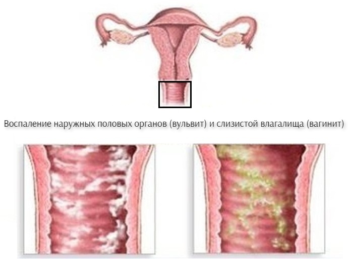 Наружные половые органы